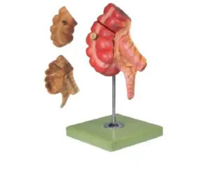 Appendix and Caecum