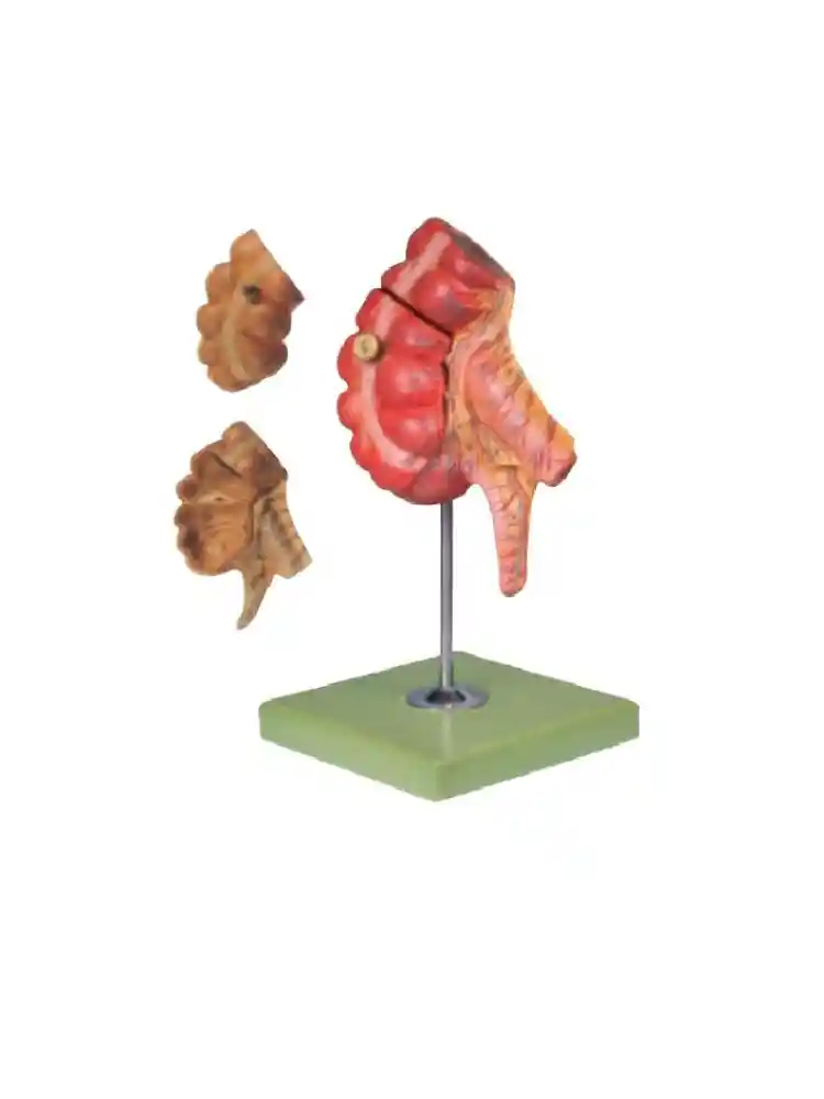 Appendix and Caecum