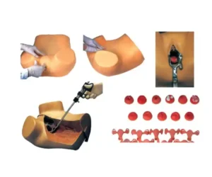Gynaecological Examination Model