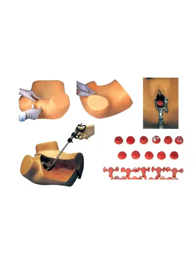 Gynaecological Examination Model