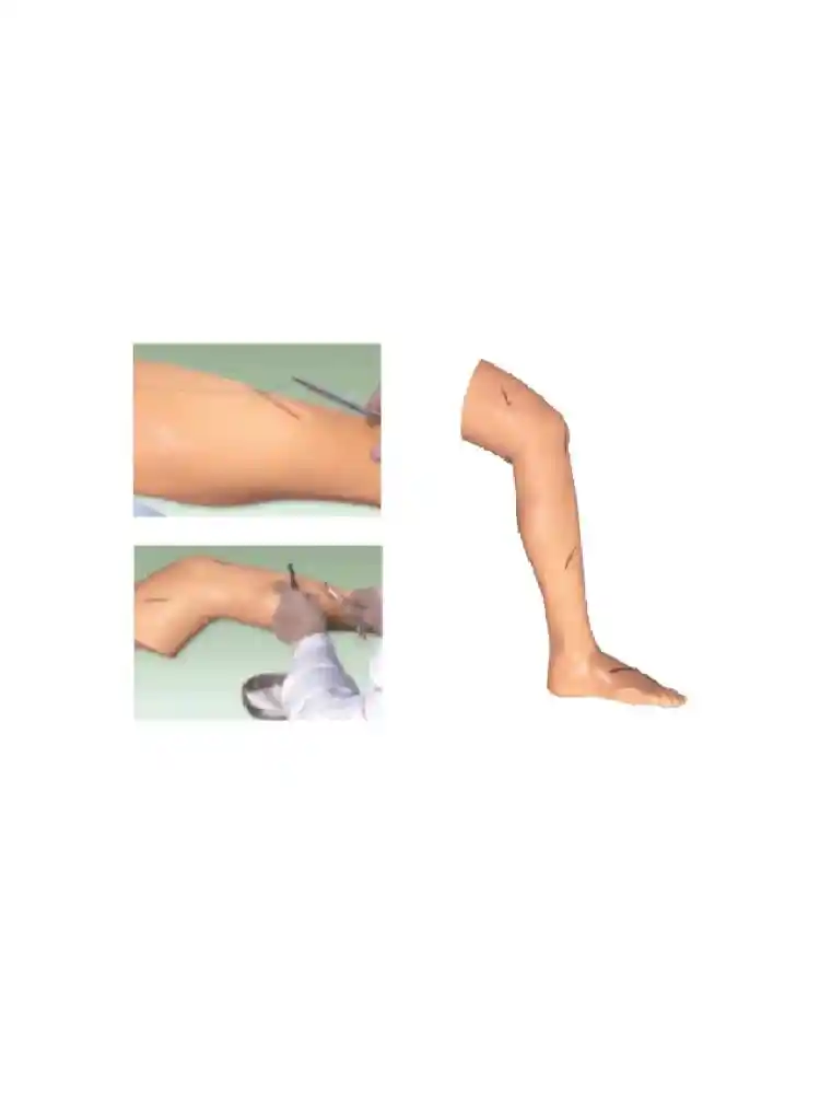 Advanced Surgical Suture Leg