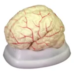 Brain with Arteries