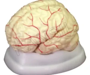 Brain with Arteries