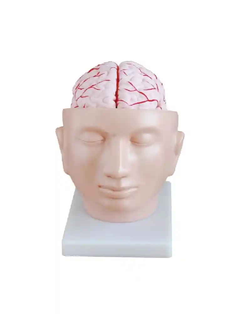 Brain with Arteries on Head