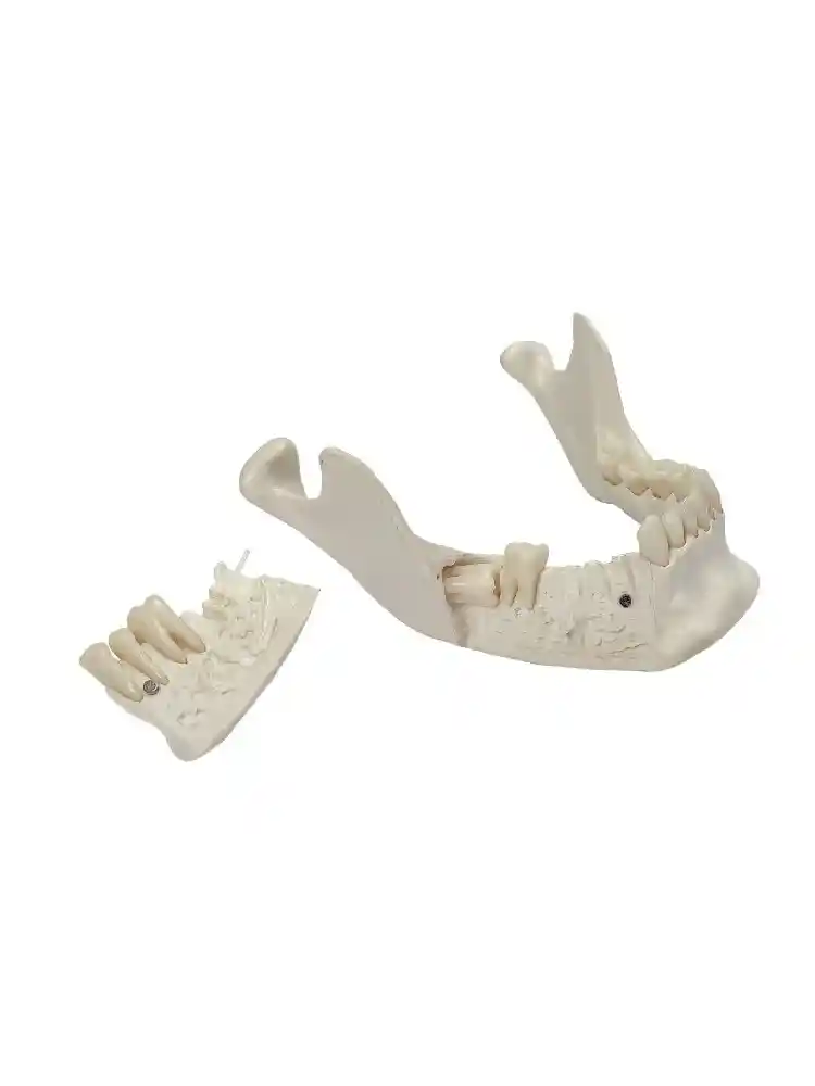 Lower Jaw Model with Extractable Teeth