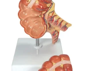 Caecum and Appendix, Enlarged