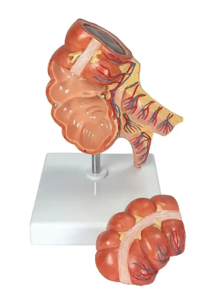 Caecum and Appendix, Enlarged