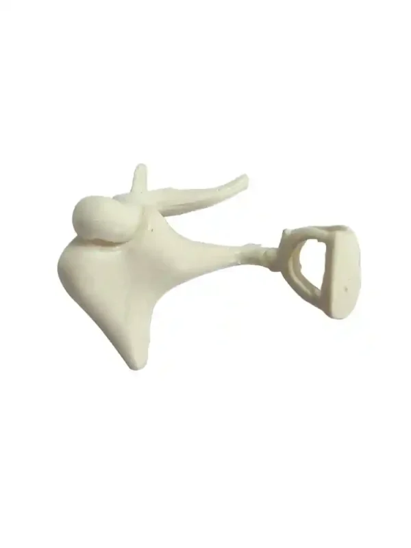 Auditory Bones, Enlarged