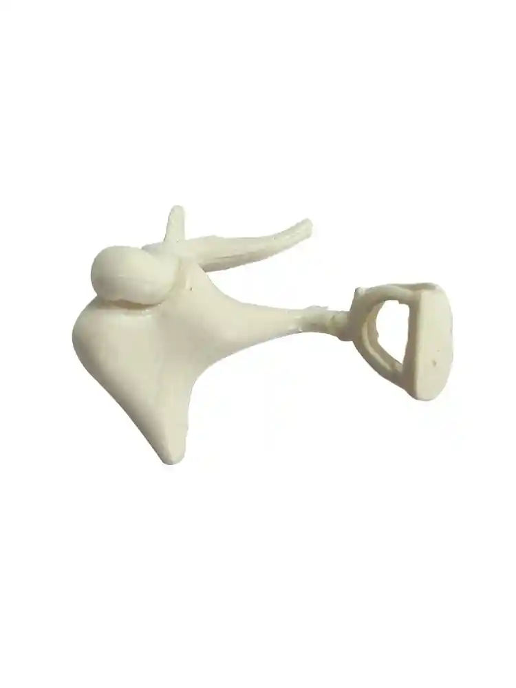 Auditory Bones, Enlarged