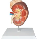 Kidney with Adrenal Gland, Enlarged