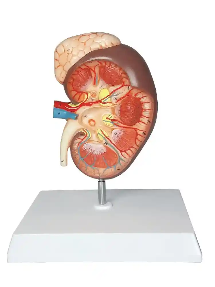 Kidney with Adrenal Gland, Enlarged