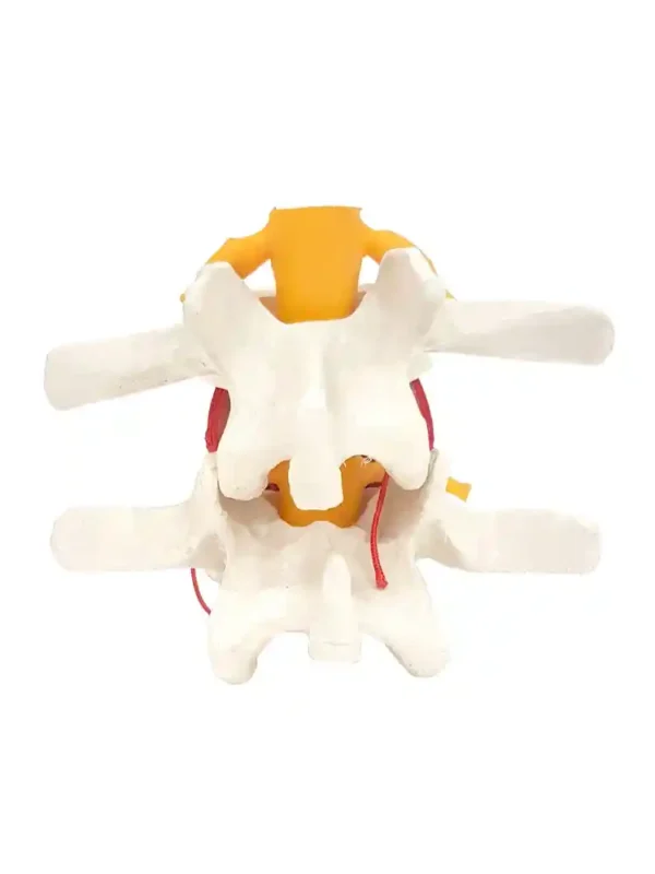 Functioning Prolapsed Lumbar Vertebrae Model - Image 3