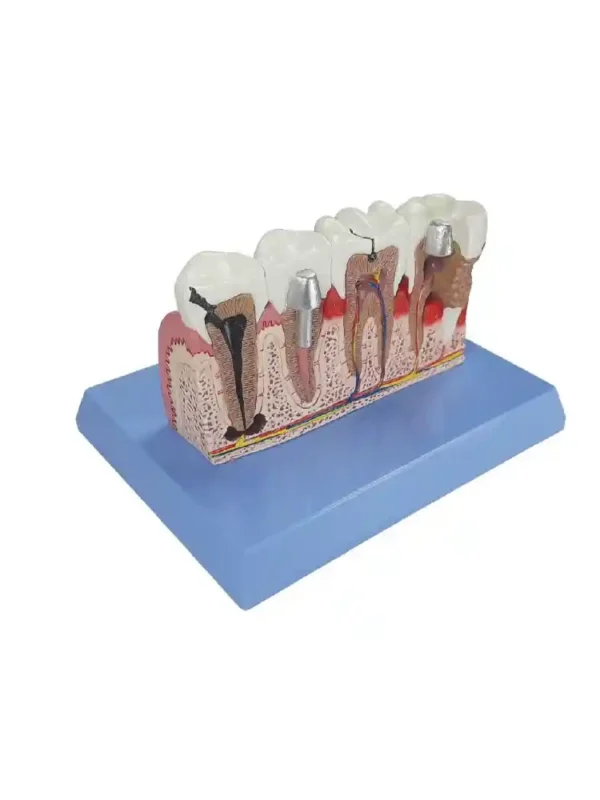 Teeth Pathologies