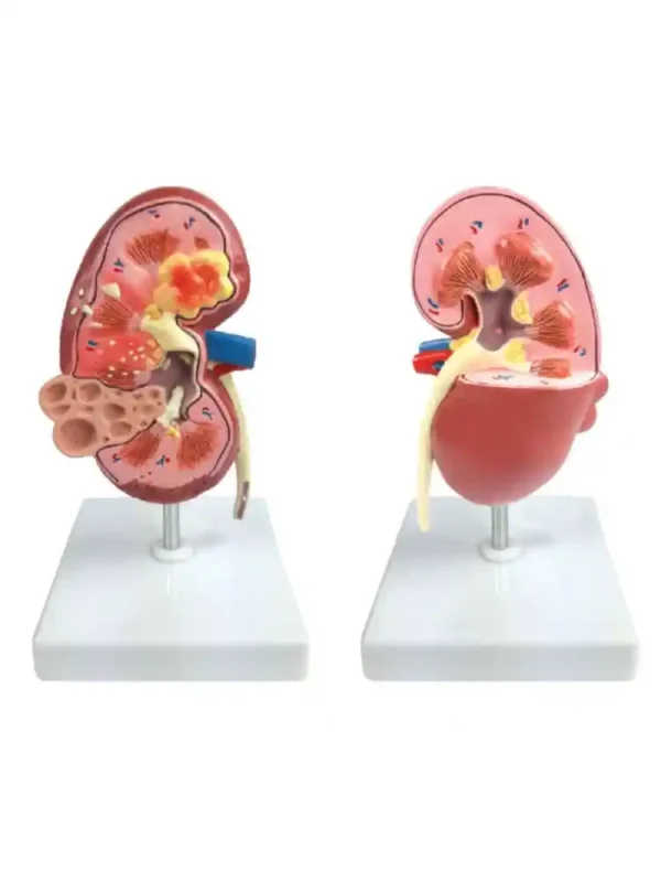Kidney Pathologies Model