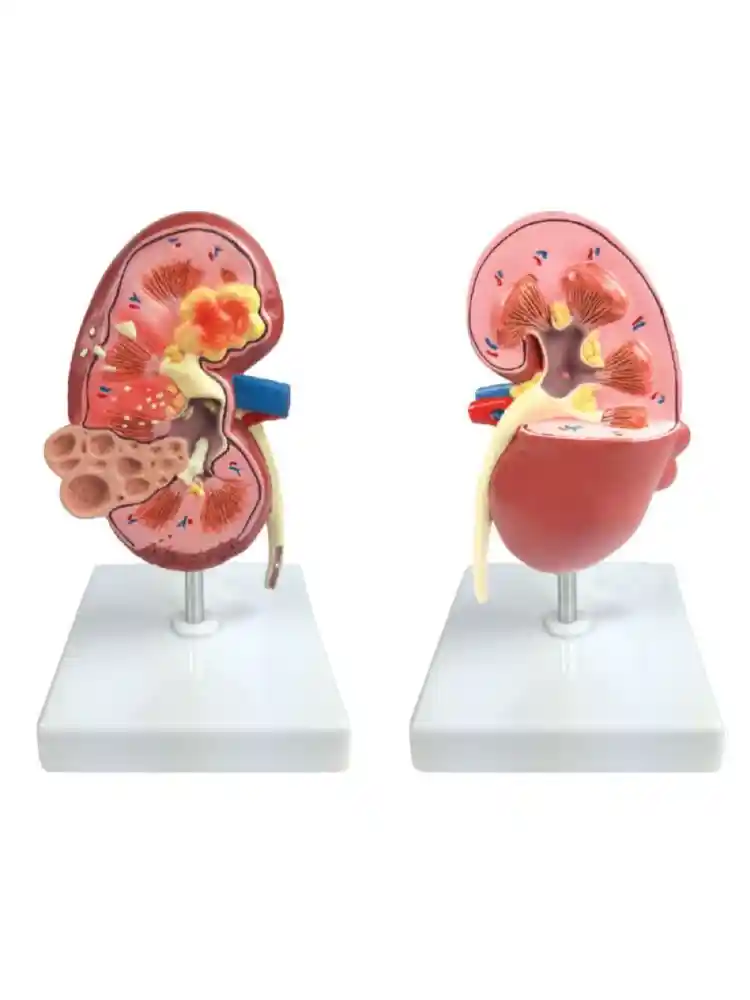 Kidney Pathologies Model