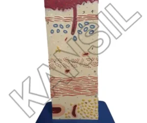 Oesophagus Wall