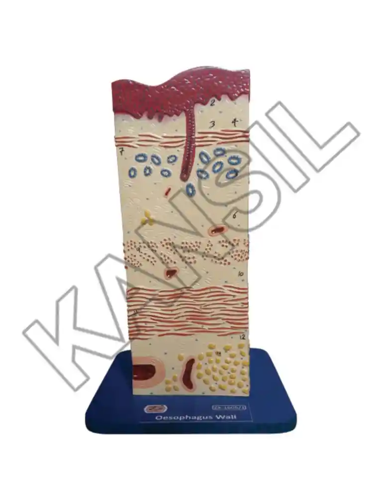 Oesophagus Wall