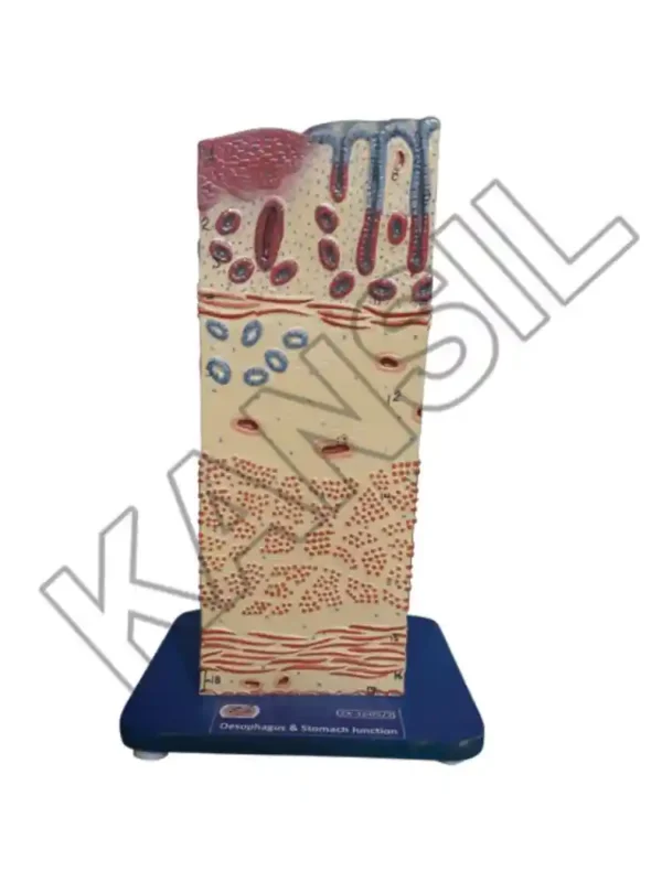 Oesophagus & Stomach Junction