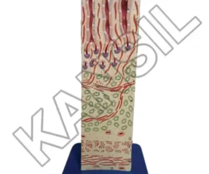 Duodenum Wall