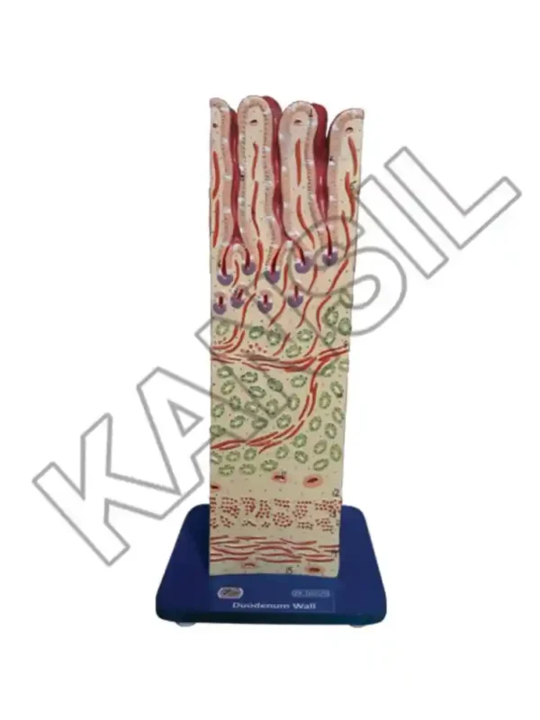 Duodenum Wall