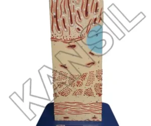 Large Intestine Wall