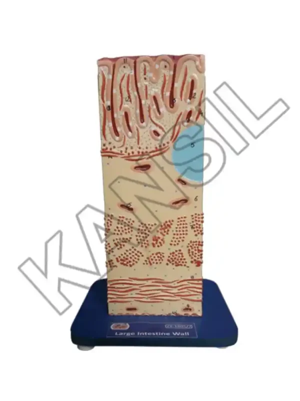 Large Intestine Wall