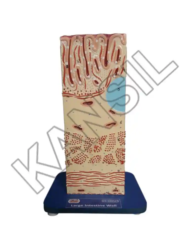 Large Intestine Wall
