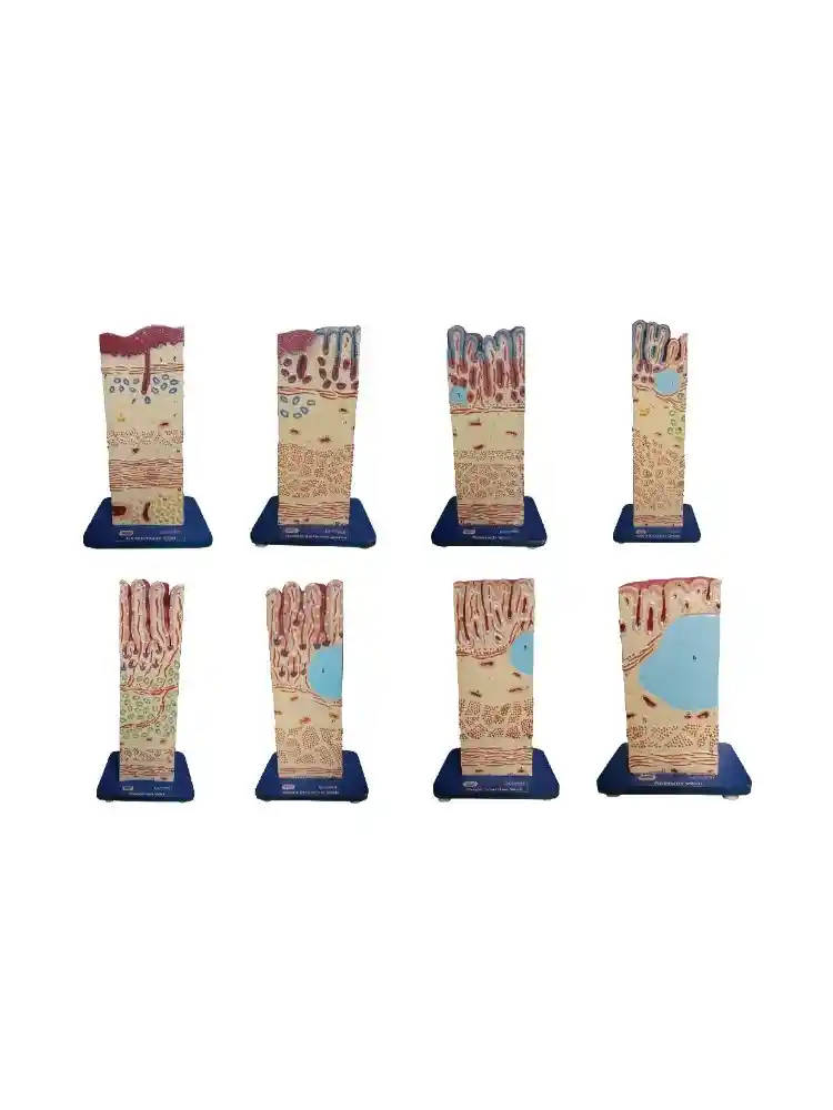 Alimentary Canal Wall Model (complete set of 8)