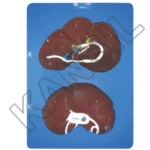 Dog Liver model on Board