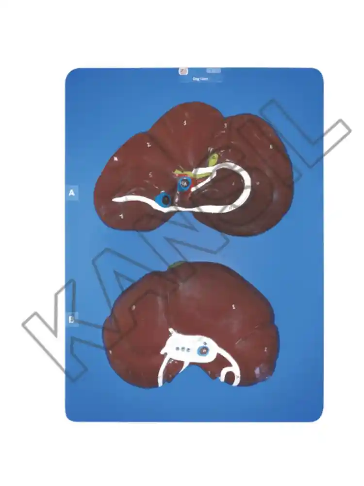 Dog Liver