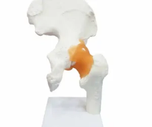 Hip Joint Model Flexible